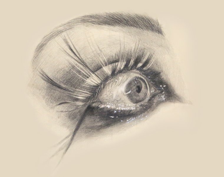 Bloodshoteyegallery